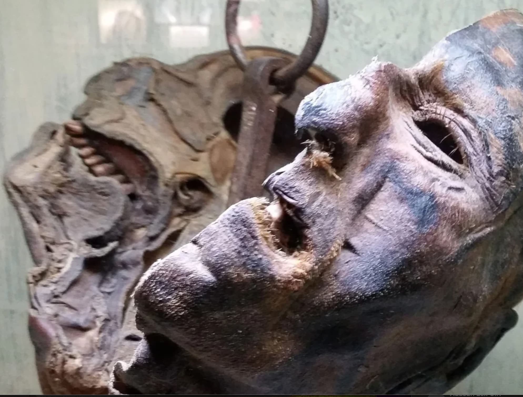 “The mummified head of serial killer Peter Kürten "der Vampir von Düsseldorf" is displayed in an museum.”